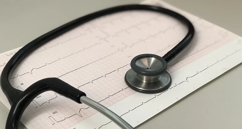 EKG