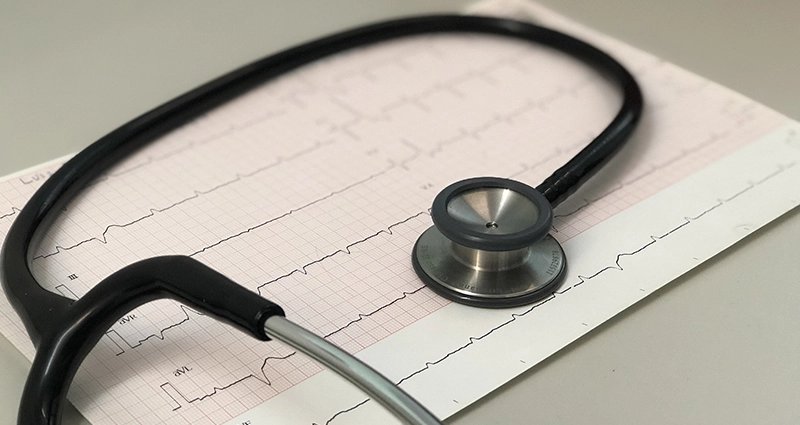EKG